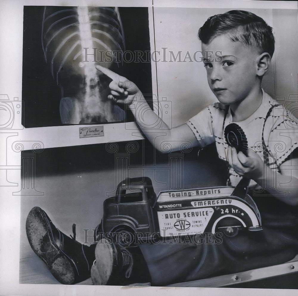 1954 Press Photo Polio Patient Ronnie Mickels - Historic Images