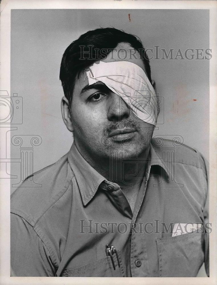 1967 Press Photo Fred Heim, CTS Bus Driver Hit By a Rock - Historic Images