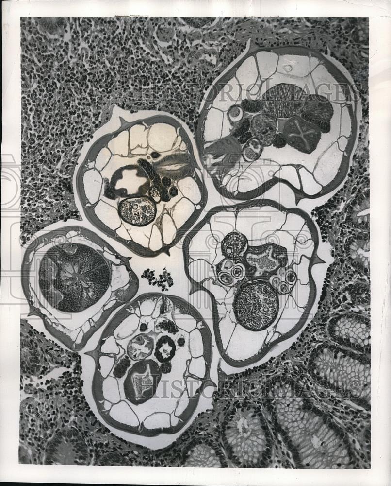 1955 Press Photo Thin section of an appendix showing a cross-section of 5 pin - Historic Images