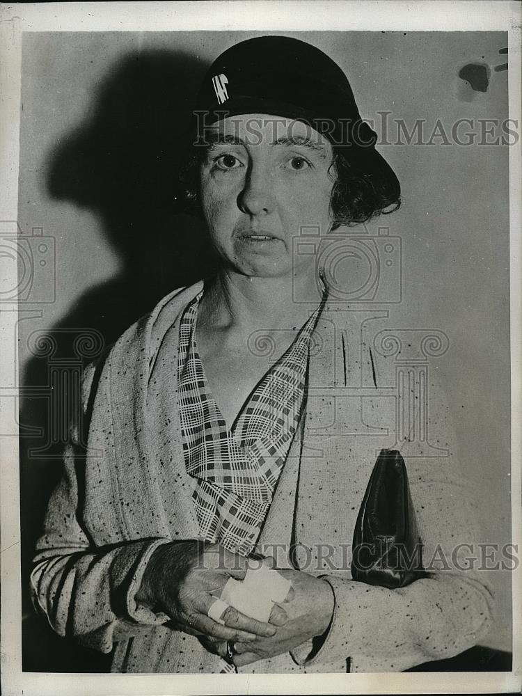 1933 Press Photo Chloe Weaver, Worker Attacked by Riot of LA Garment Strikers - Historic Images