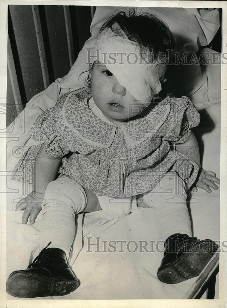 1941 Press Photo Carol Frederickson after a tumor operation was performed to - Historic Images