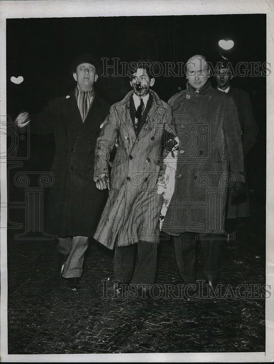 1934 Press Photo Wounded from Fighting at Pont De La Concorde - Historic Images