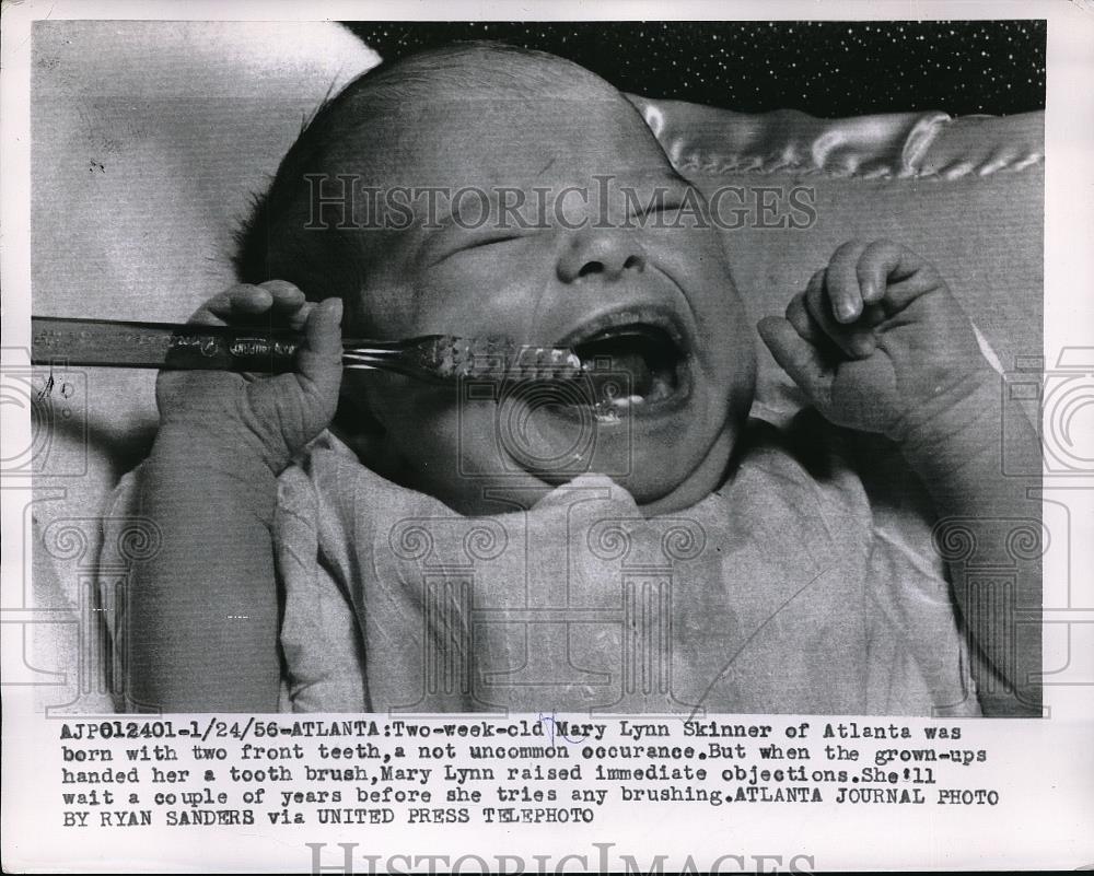 1956 Press Photo Two-week-old Mary Lynn Skinner born w/ 2 front teeth objecting - Historic Images