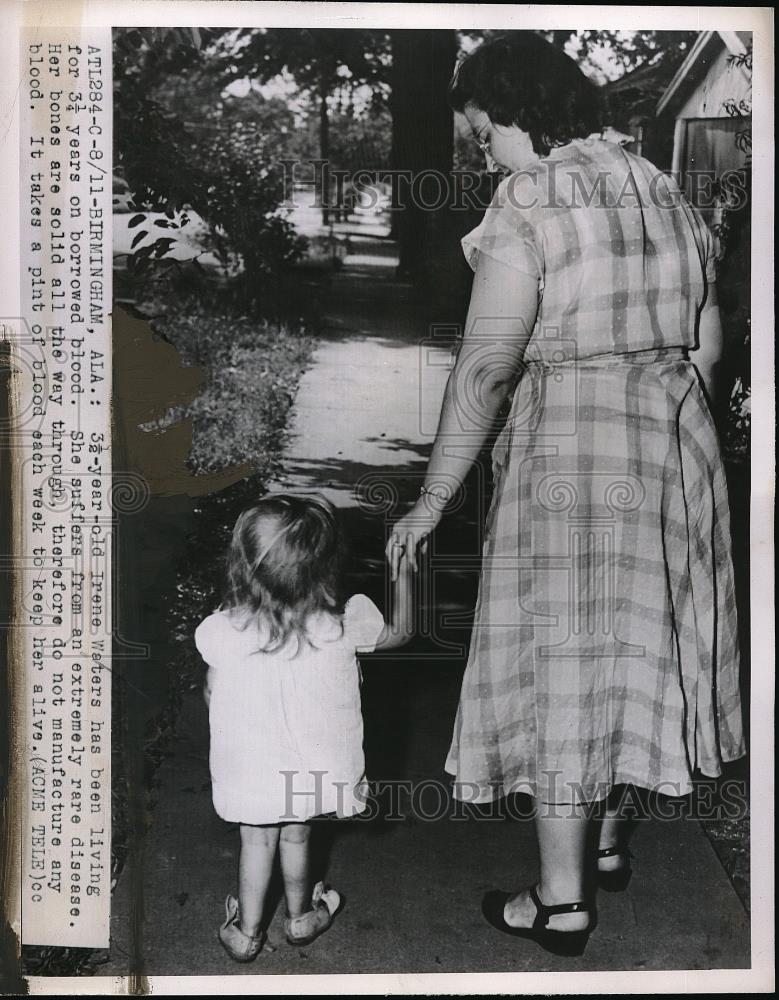 1950 Press Photo Irene Waters Age 3 Has to take Pint of Blood Each Week - Historic Images