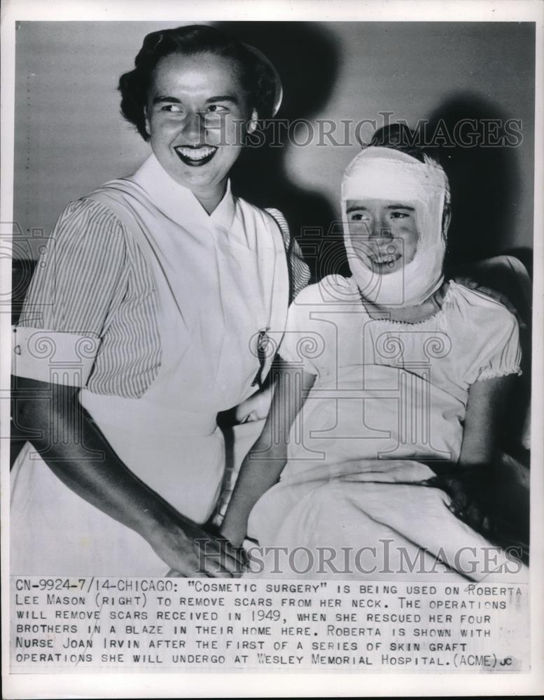 1950 Press Photo Chicago, Roberta Lee Mason has skin grafts, nurse J Irvin - Historic Images