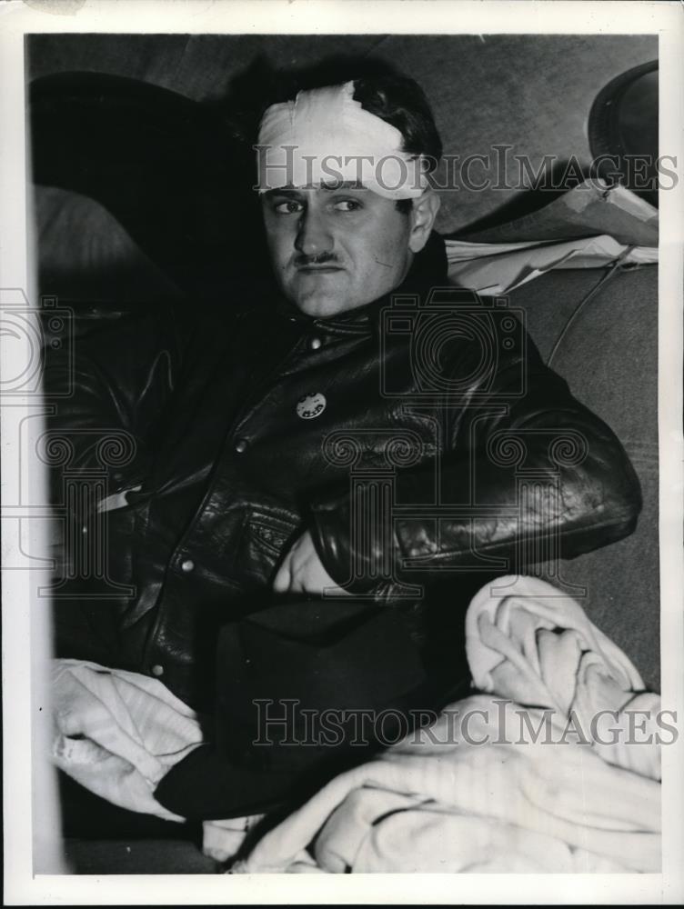 1941 Press Photo union leader William Adelman injured in picket clash, Bendix NJ - Historic Images