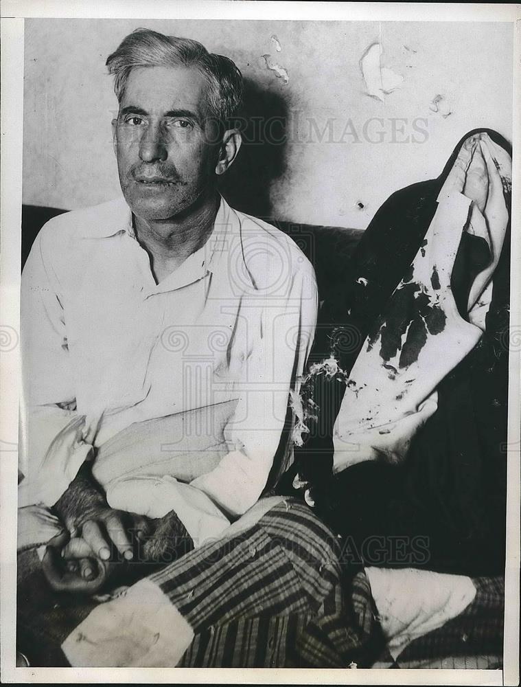 1935 Press Photo Harley Thompson Salesman Recovering From The Effects Of Tarred - Historic Images