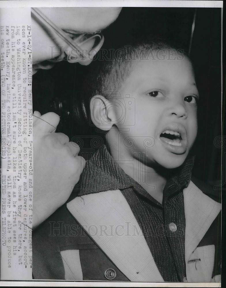 1954 Press Photo St Louis,Henry Robinson, age 5 gets dentures due to dyplasia - Historic Images