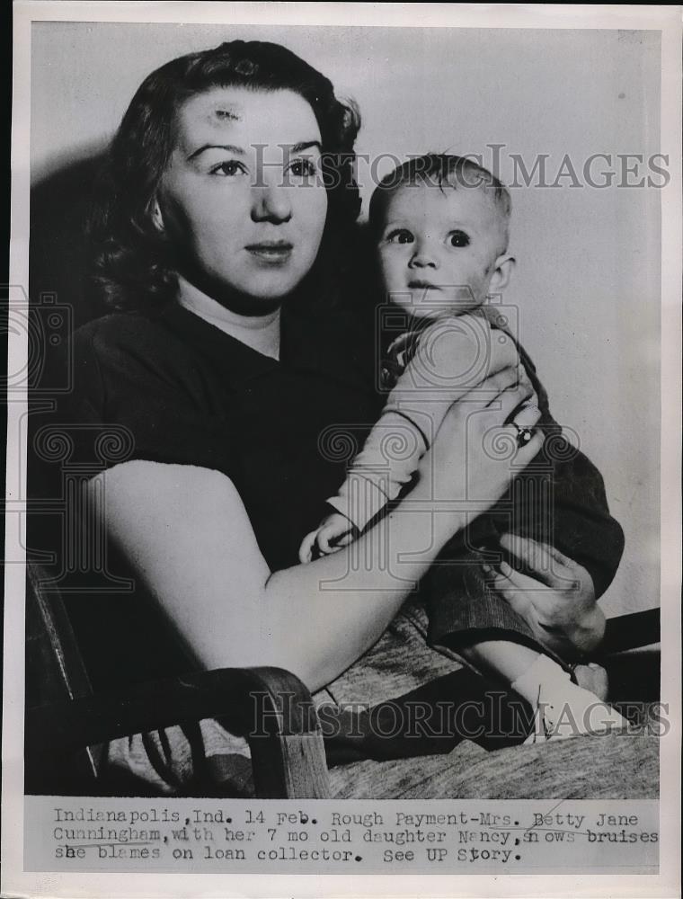 1952 Press Photo Mrs Betty Jane Cunningham Daughter Nancy Bruised Accident - Historic Images