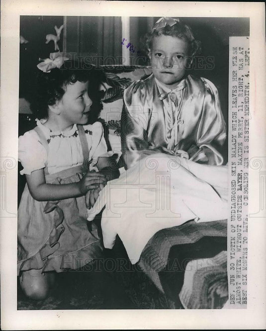 1948 Press Photo Maxine Perry with skin malady & sister Meredith - Historic Images