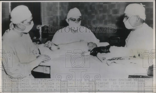 Press Photo 3 Physicians drained blood from baby's ankle, new blood was injected - Historic Images