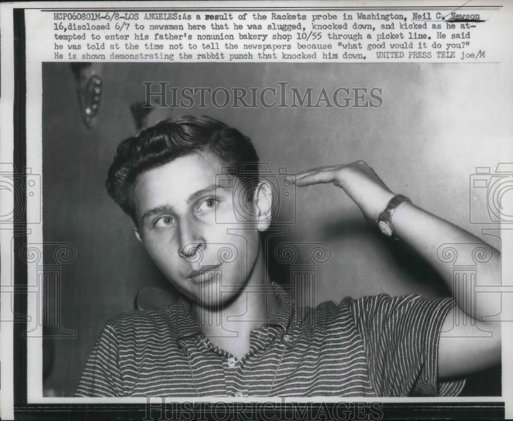 1957 Press Photo La, Calif. Neil C Newson injured at dad non union bakery - Historic Images