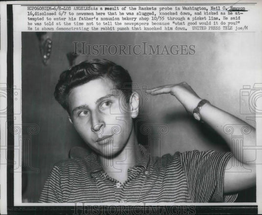 1957 Press Photo La, Calif. Neil C Newson injured at dad non union bakery - Historic Images