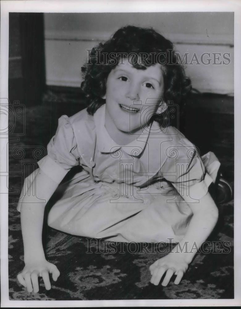 1954 Press Photo spina bifida victim Lilliam Berchem dances with her arms - Historic Images