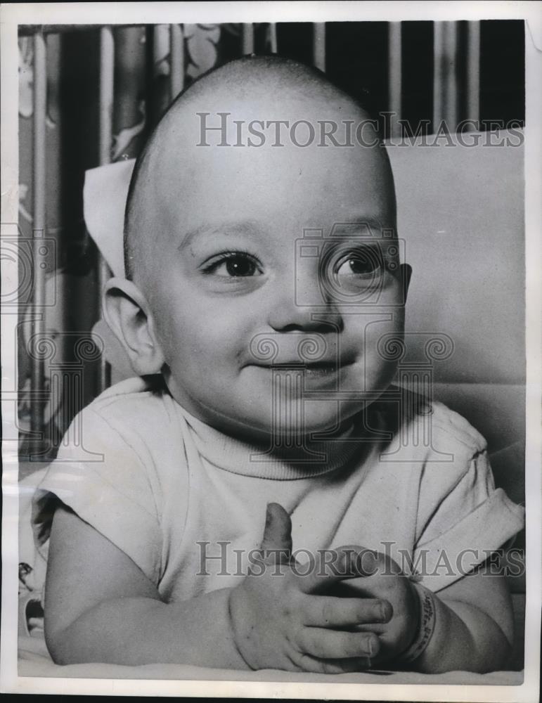 1958 Press Photo Oakland, Calif. baby Rita Ann Clark after operation on head - Historic Images