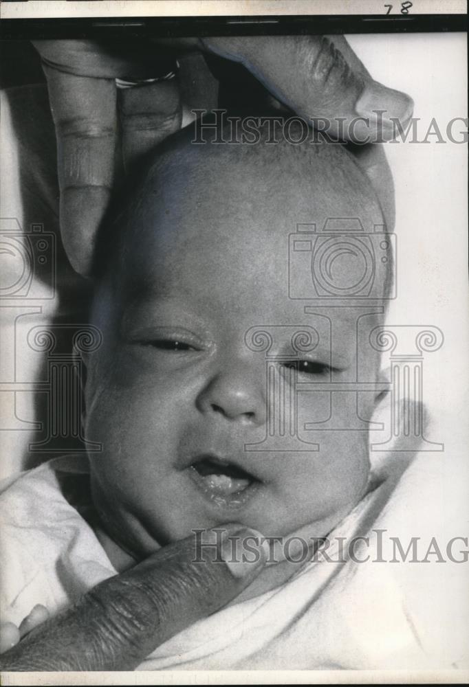 1971 Press Photo Judith Wohlman has two teeth at 2 months old, Houston TX - Historic Images