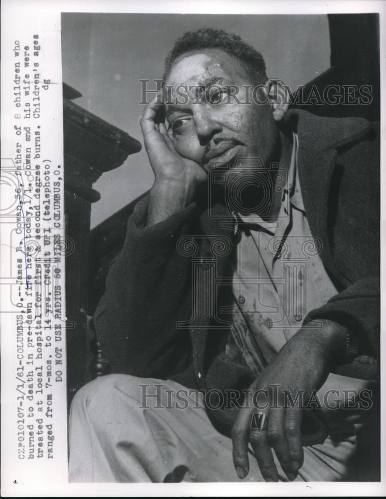 1961 Press Photo James R. Cowan, Father of 8 Children Burned in Columbus Fire - Historic Images