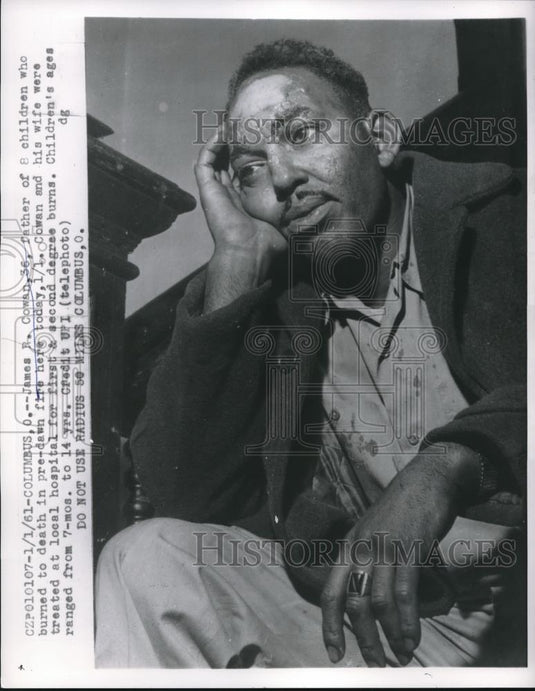 1961 Press Photo James R. Cowan, Father of 8 Children Burned in Columbus Fire - Historic Images