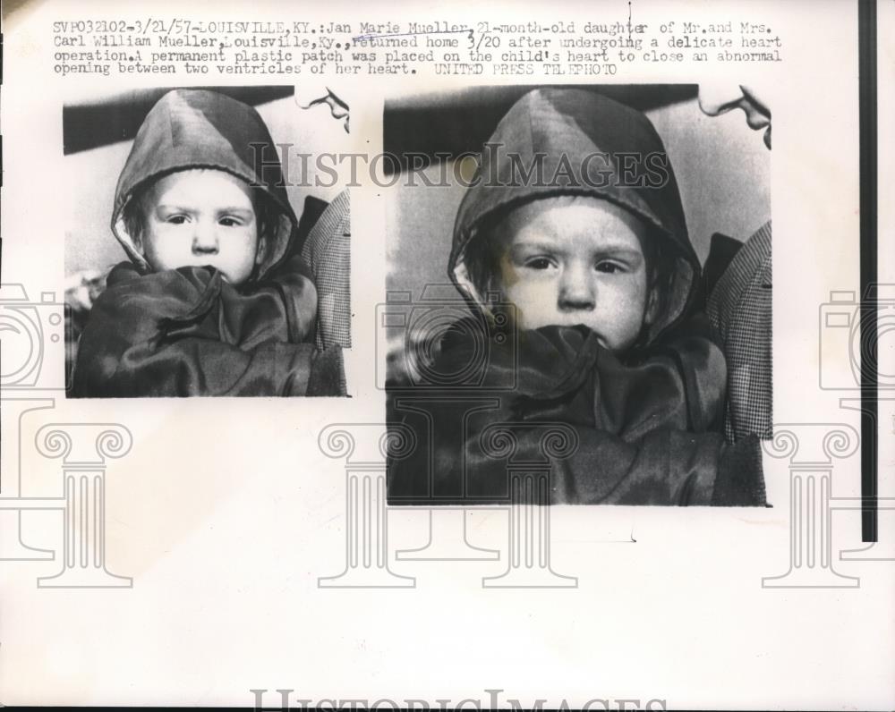 1957 Press Photo Toddler revering from open heart surgery in Louisville ,Kt. - Historic Images