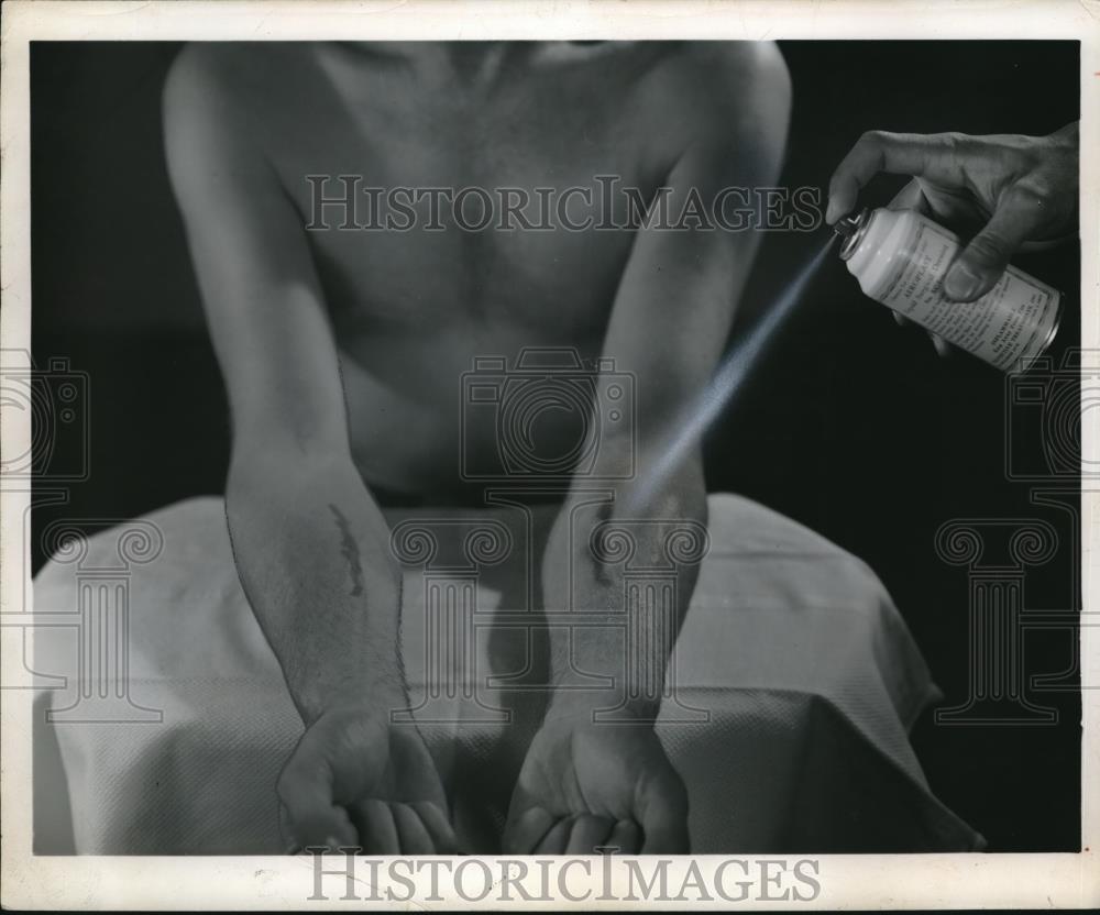 1954 Press Photo Aerosol Spraying Surgical Dressing - Historic Images