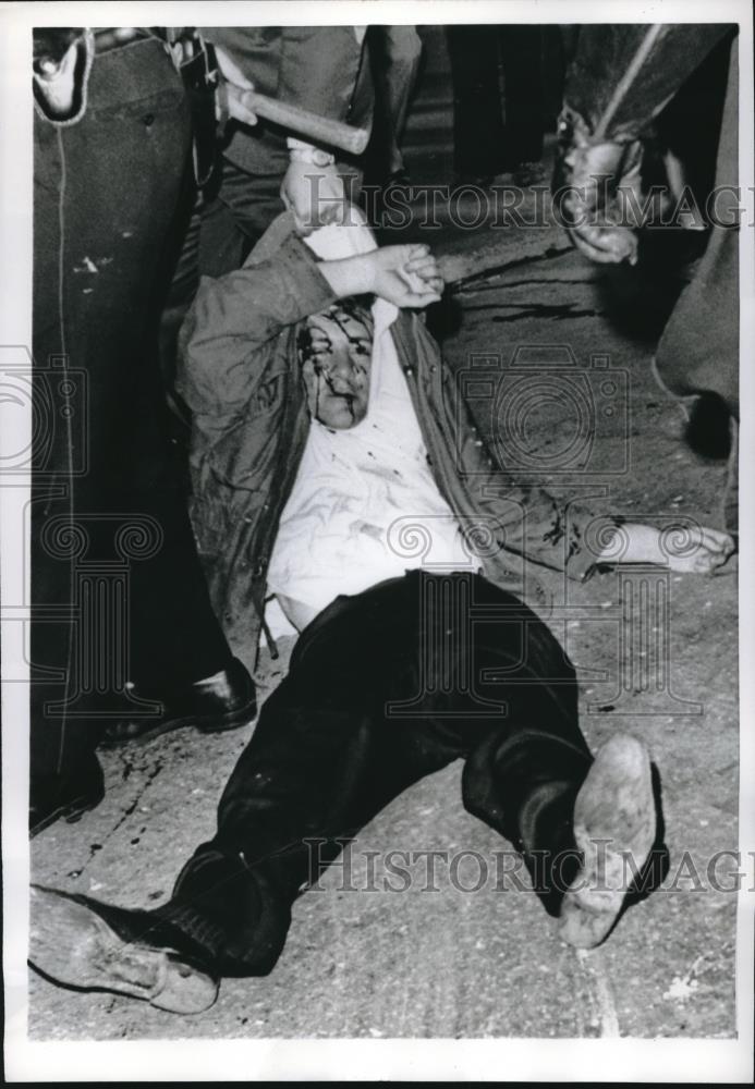 1968 Press Photo Bloody Demonstrator On The Ground During French Canadian - Historic Images