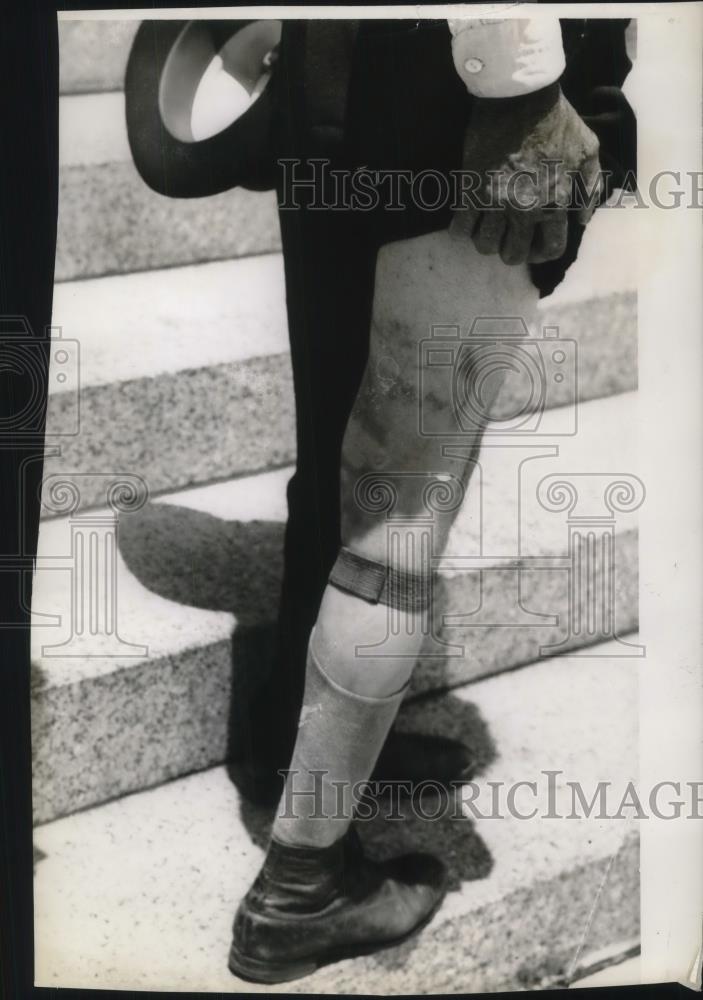 1937 Press Photo A Leg - nec28244 - Historic Images