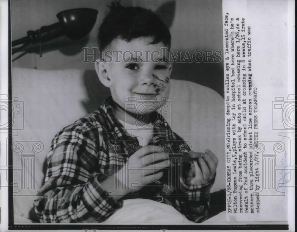 1954 Press Photo Boy recovers from being hit by car - nec37859 - Historic Images