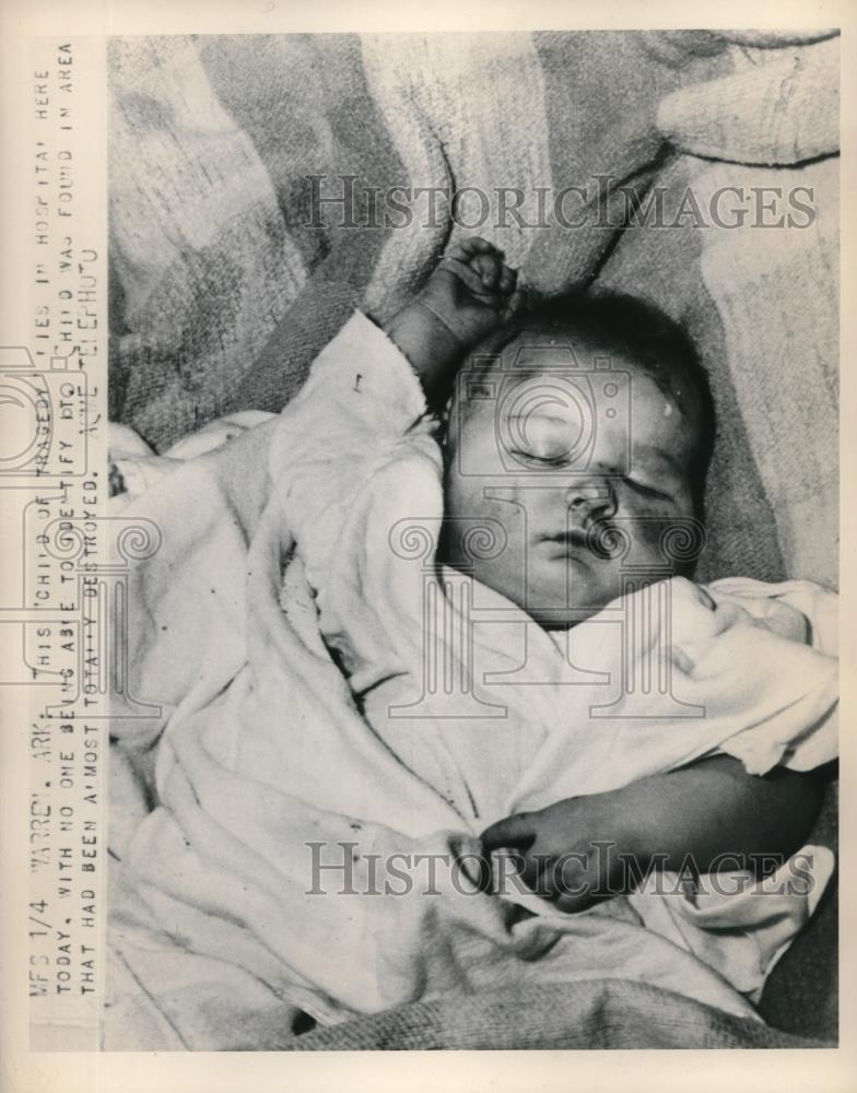 1949 Press Photo Child of Tragedy - Historic Images