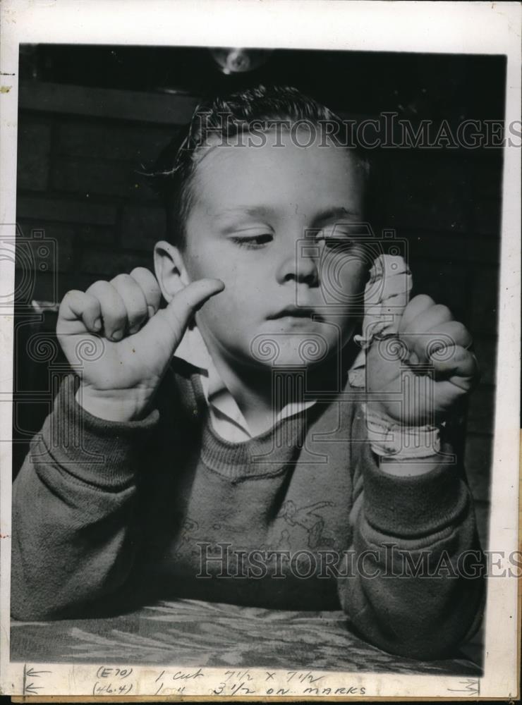 1946 Press Photo Billy Rice at Age 4 With Cut-Off Thumb That Was Buried - Historic Images