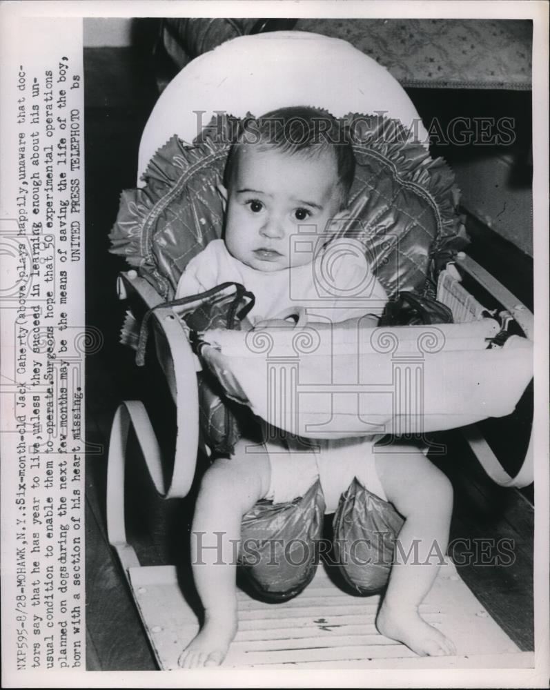 1952 Press Photo Baby Jack Gaherty Happy Although Section Of Heart Missing - Historic Images