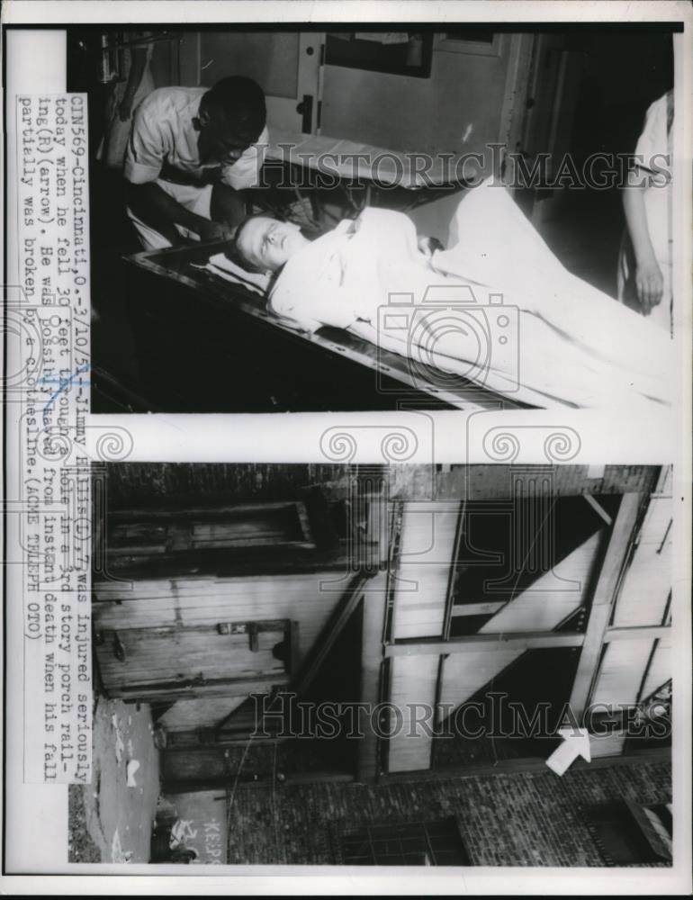 1951 Press Photo Jimmy Hillis injured by fallingf from 3 story porch, Cincinnati - Historic Images