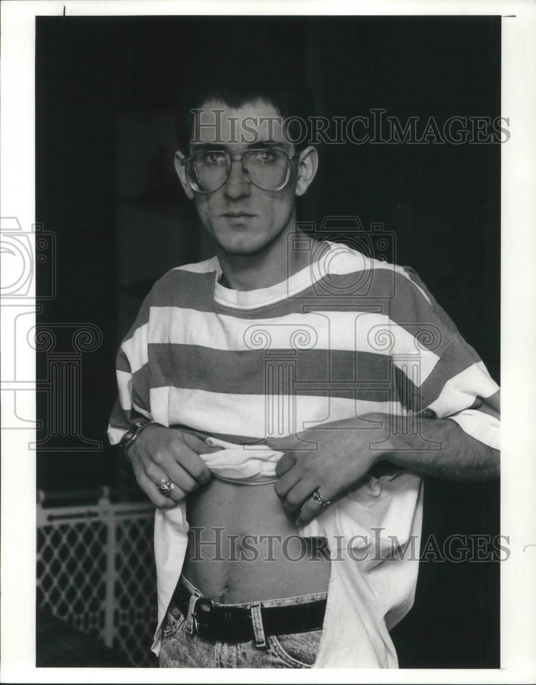 1991 Press Photo Rodd Dunlap, a security guard from Ahmerst, Ohio, shows bruise - Historic Images