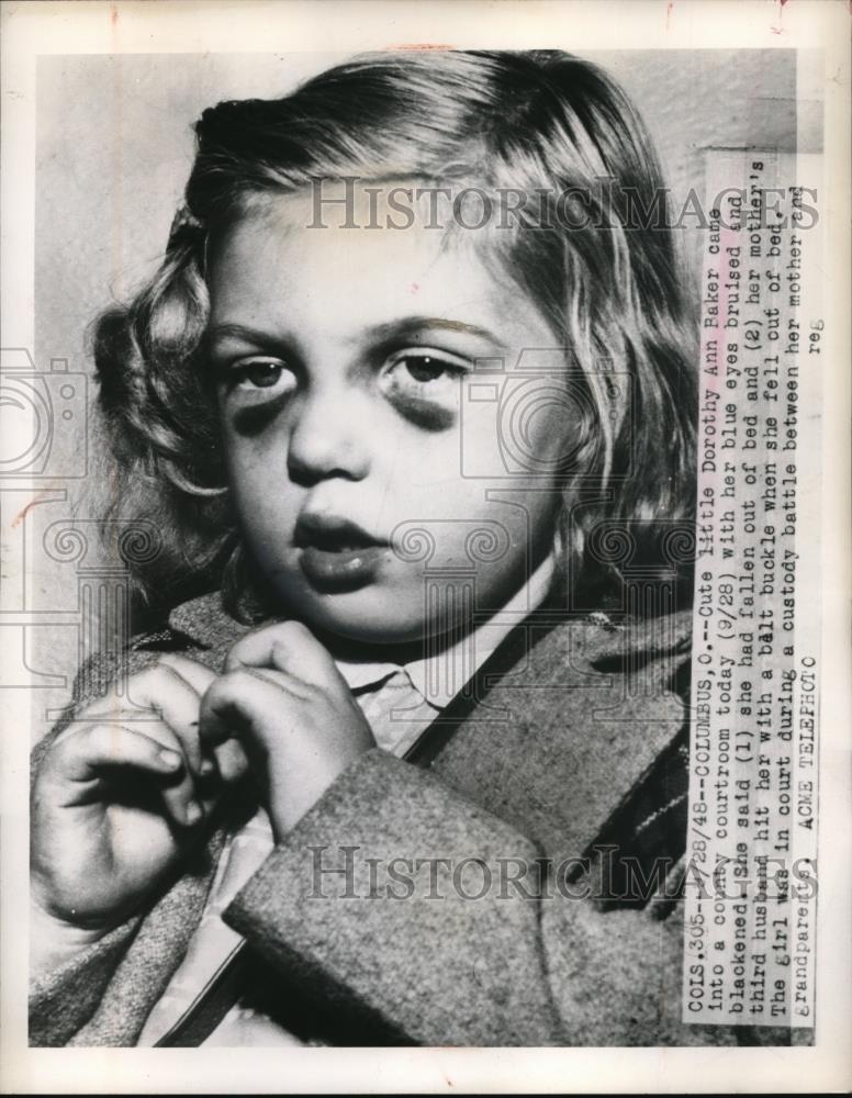 1948 Press Photo Dorothy Ann Baker hit by her mother&#39;s third husband by Belt - Historic Images