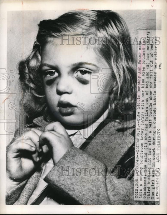 1948 Press Photo Dorothy Ann Baker hit by her mother's third husband by Belt - Historic Images