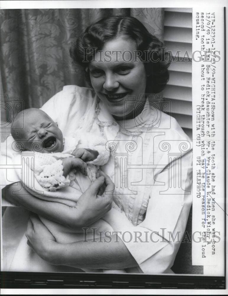 1960 Press Photo Wichita Sue Redick Claude Child Tooth About To Break Through - Historic Images