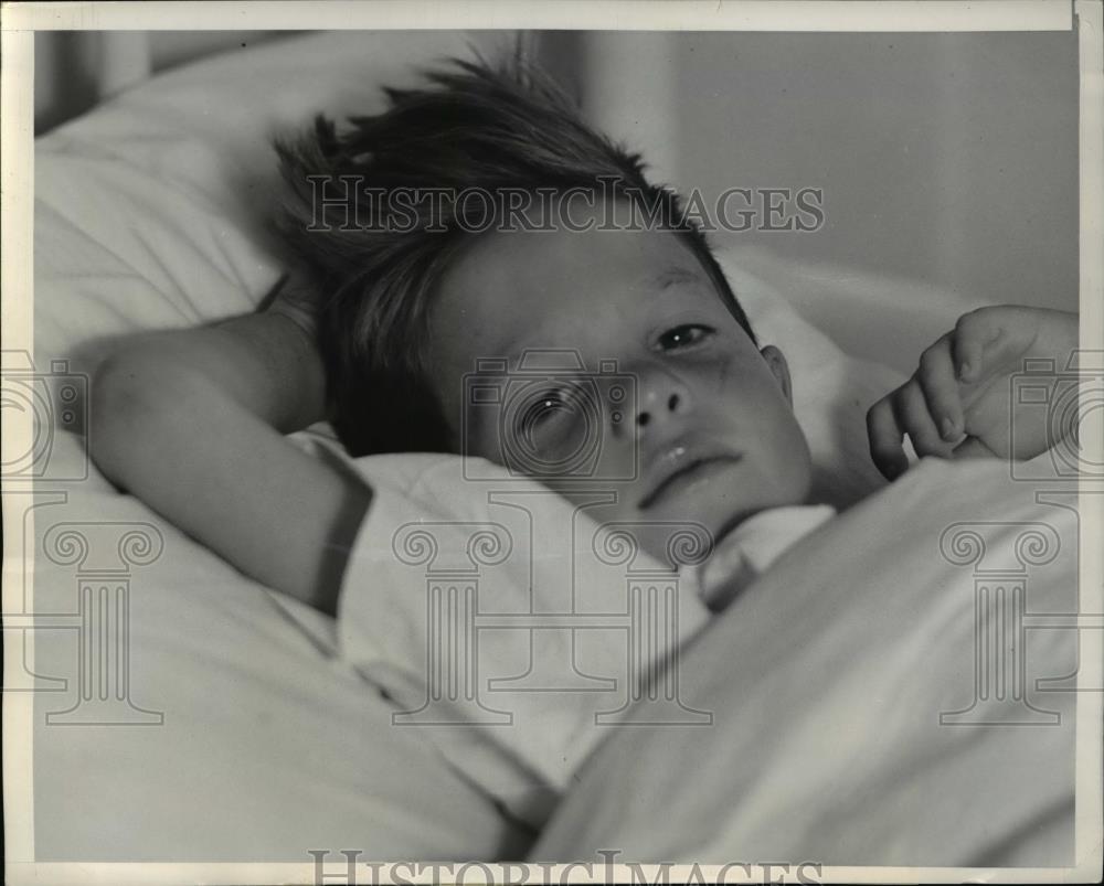 1939 Press Photo Bruce Crozier recovering from severe exhaustion - Historic Images