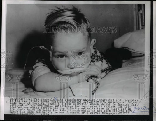 1955 Press Photo Mike Stansberry's SurgicalAdventure - Historic Images
