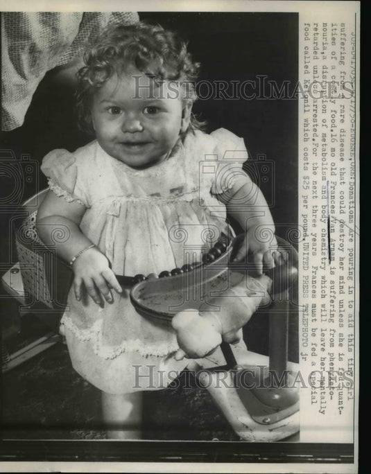 1958 Press Photo Baby Frances Van Arnam suffering from phenyketonouria - Historic Images