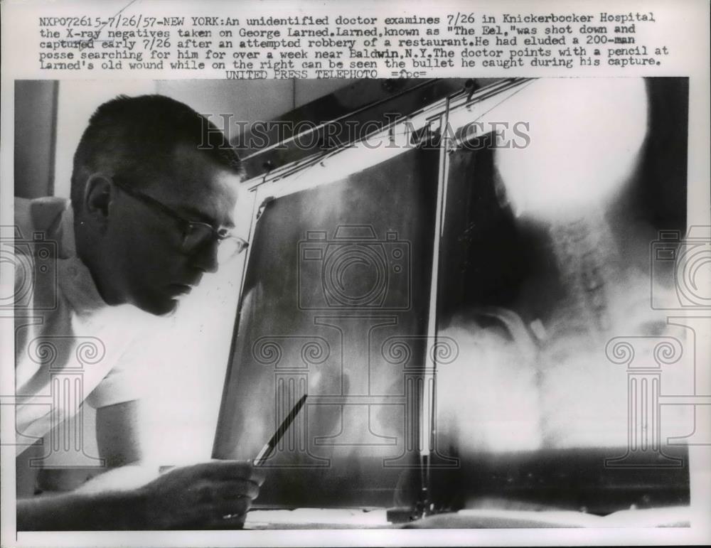 1957 Press Photo A doctor examines the X-ray negatives taken on George Larned - Historic Images