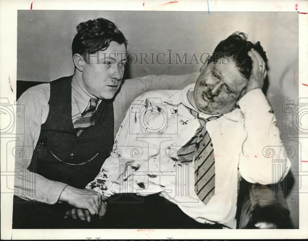 1937 Press Photo Richard Frankensteen Beaten During Riot - Historic Images