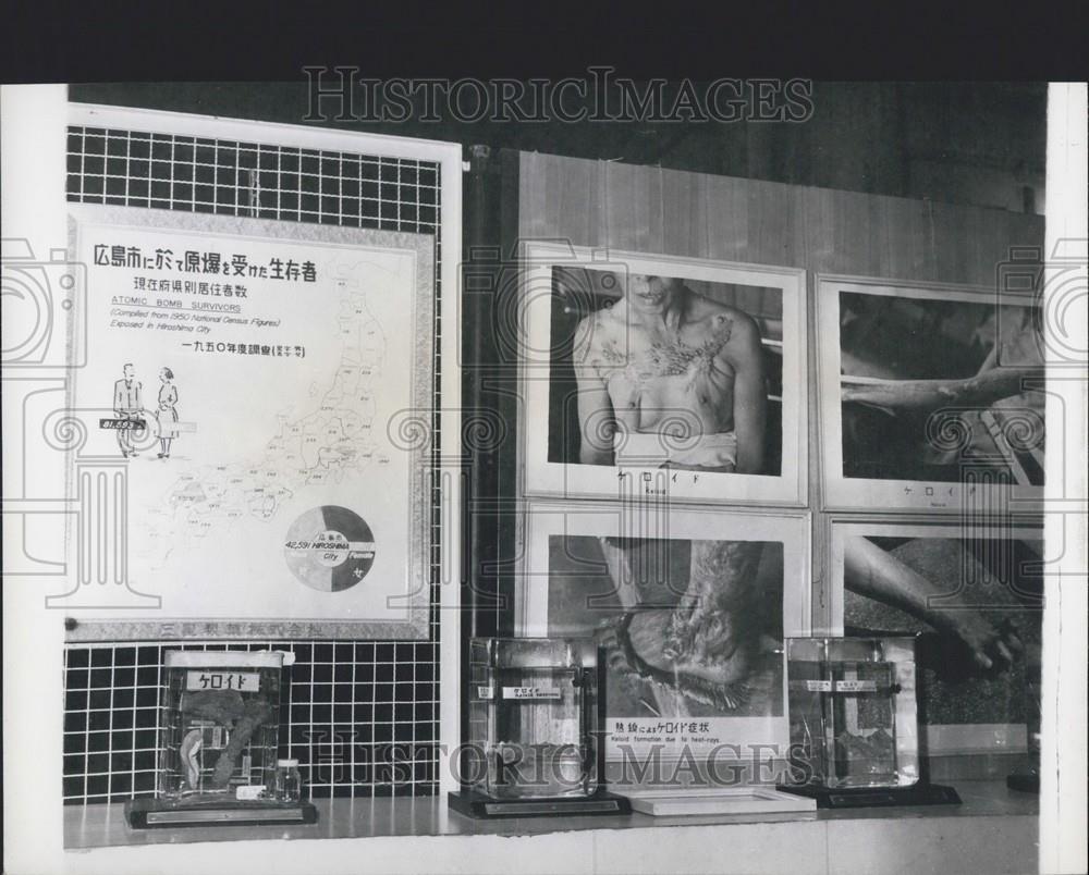 1959 Press Photo Charts In -Bomb Memorial Museum Show Effects Of Nuclear Blast - Historic Images