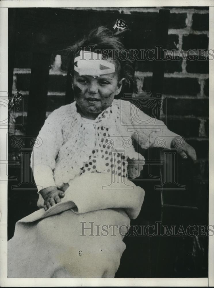 1932 Press Photo Twenty two months baby Jewel Butler after the tornado - Historic Images