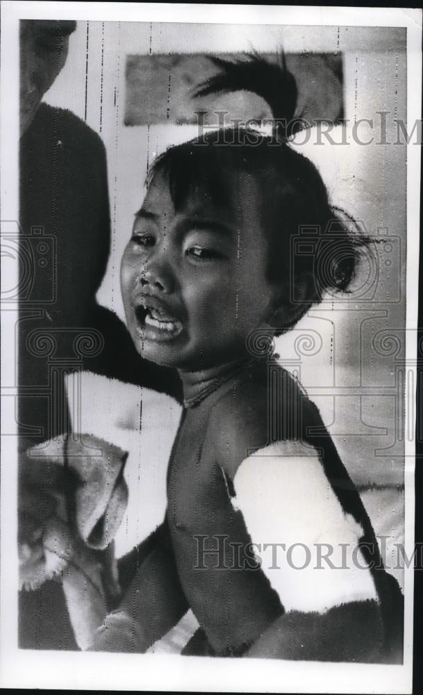 1968 Press Photo A frightened child was treated for sharpnel wounds at a - Historic Images