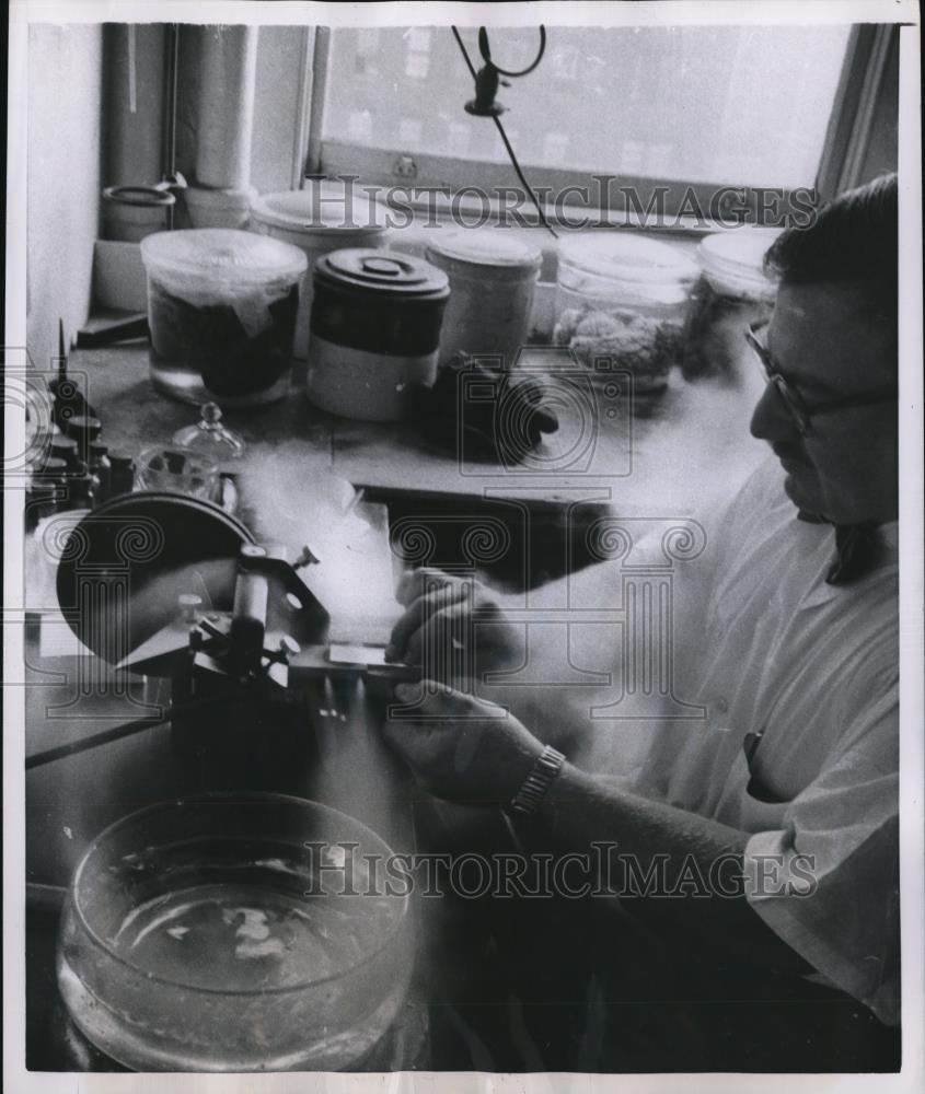 1956 Press Photo Pathologist works very hard - Historic Images