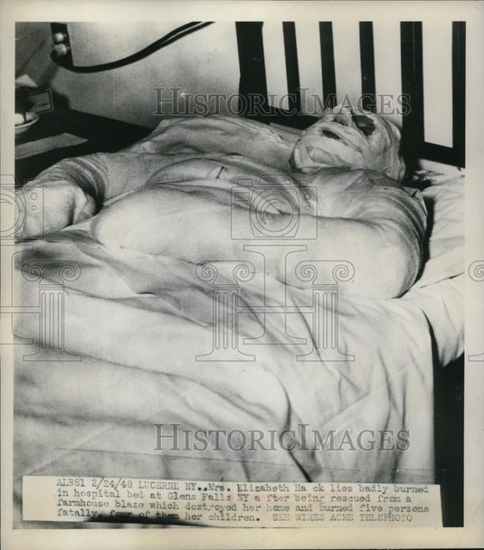 1948 Press Photo Mrs. Elizabeh Hack on her hospital bed due to farmhouse blaze - Historic Images
