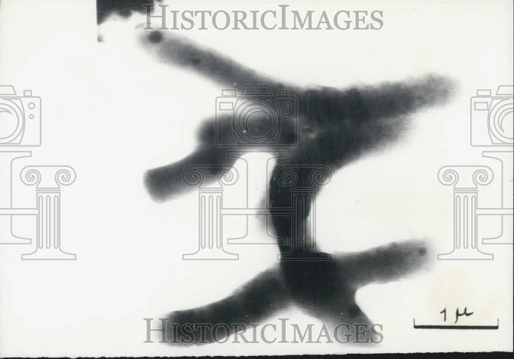 Press Photo Corynebacterium Sample - Historic Images