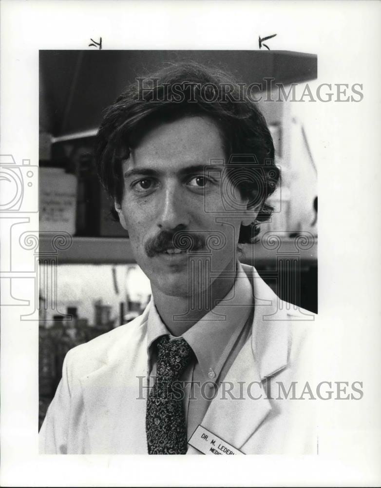 1985 Press Photo Dr. MichaelM. Lederman of the University Hospitals - Historic Images