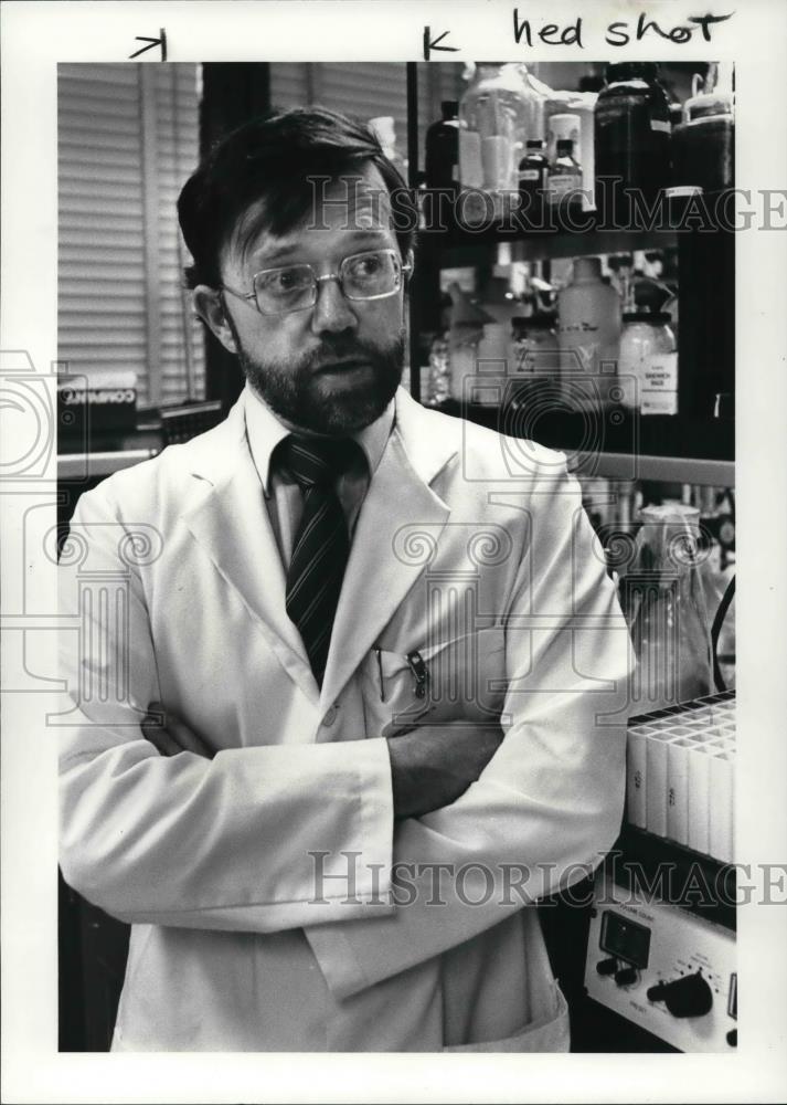 1986 Press Photo Dr. Vincent M. Monnier, CWRU Medical School pathologist - Historic Images