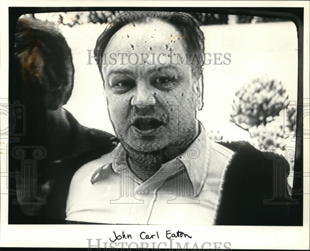 1985 Press Photo John Carl Eaton with a face dotted with blood - ora31414 - Historic Images