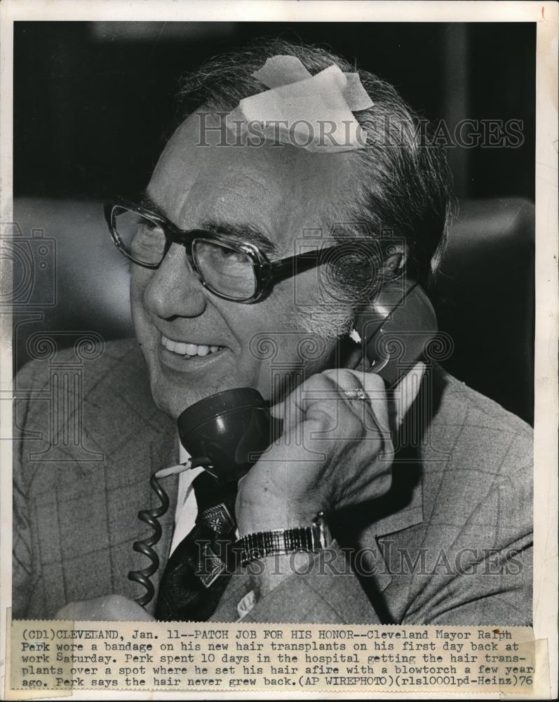 1976 Press Photo Mr. Ralph Perk with his new hair transplants - Historic Images